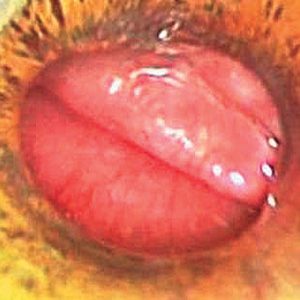 Borde de Epiglotis
