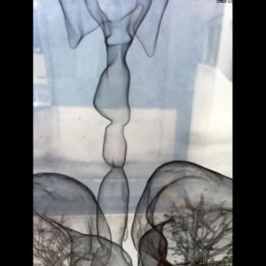 Estenosis Traqueal Doble