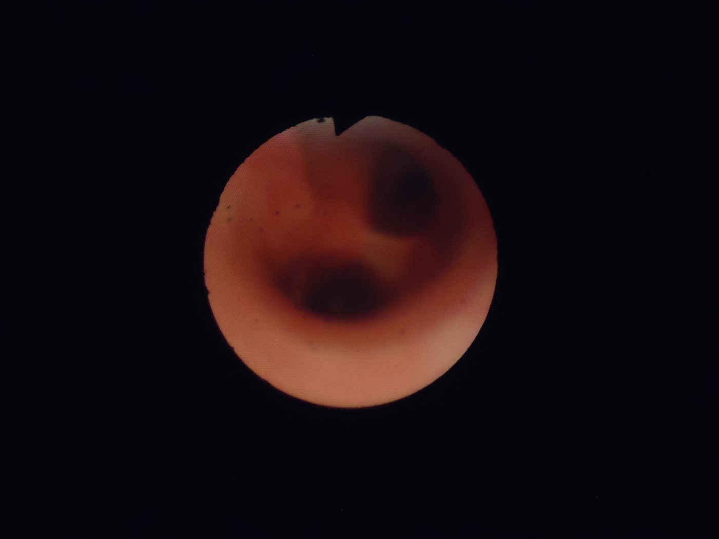Carina &mdash; traqueobroncoscopia veterinaria