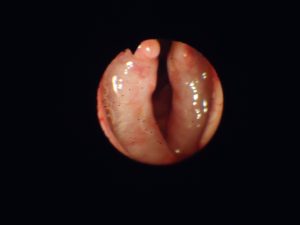 Endoscopia veterinaria con prótesis laríngea Stening®